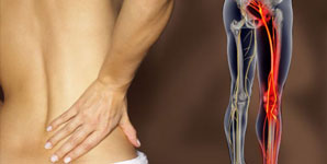 Sciatica & Osteopathy