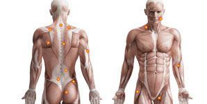 What is a Trigger Point?